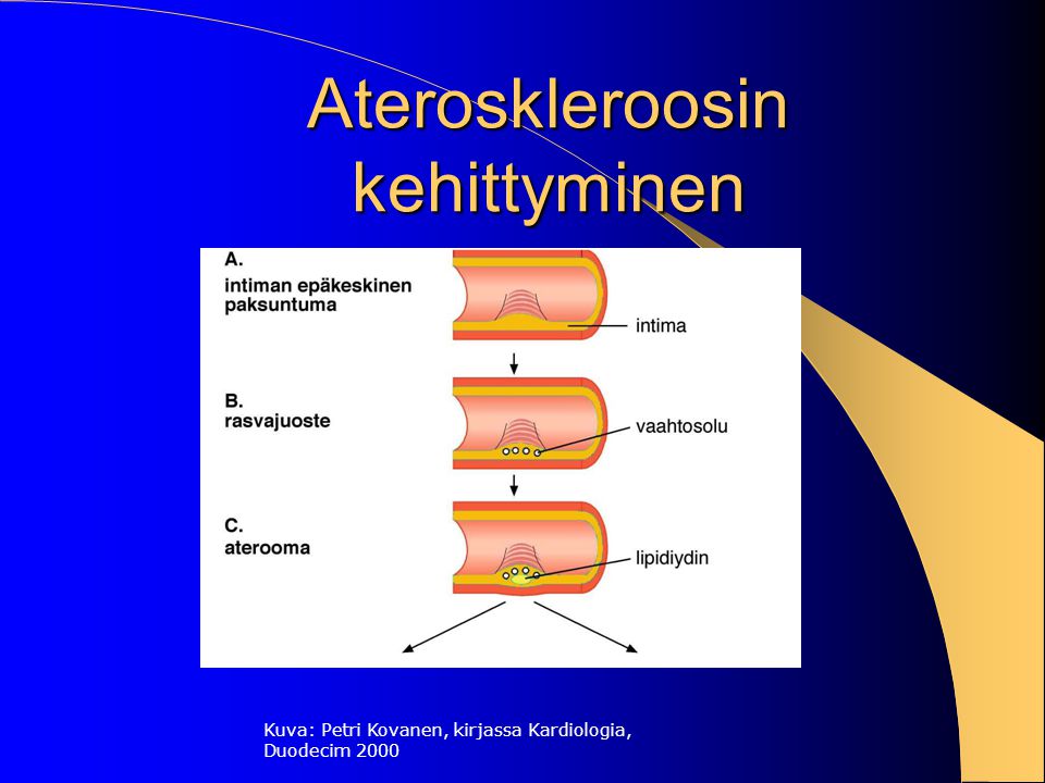 Ateroskleroosin kehittyminen