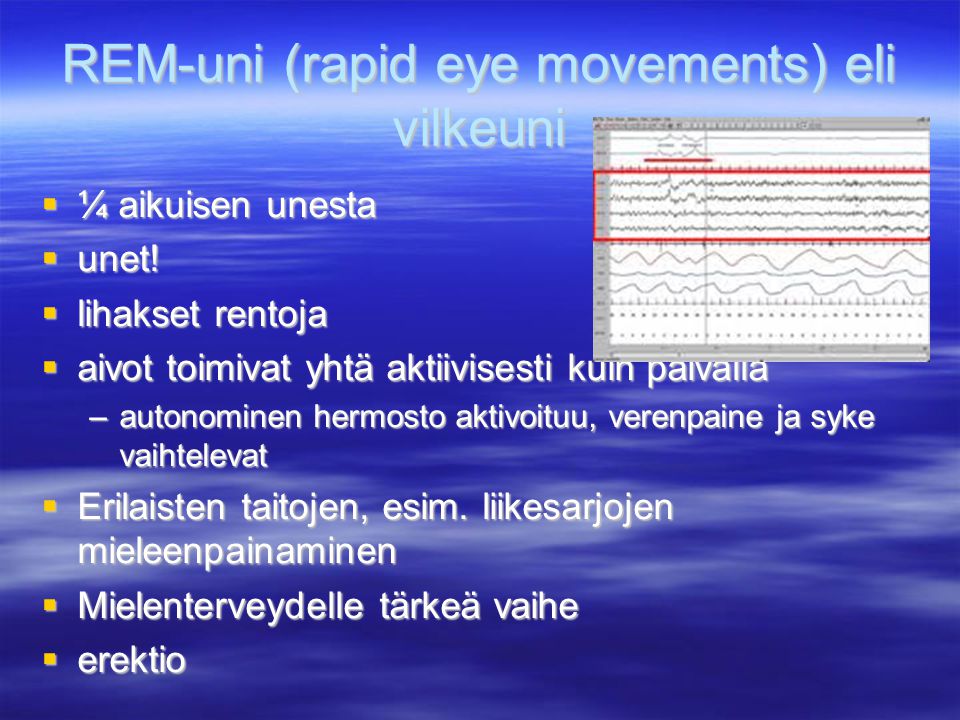 REM-uni (rapid eye movements) eli vilkeuni