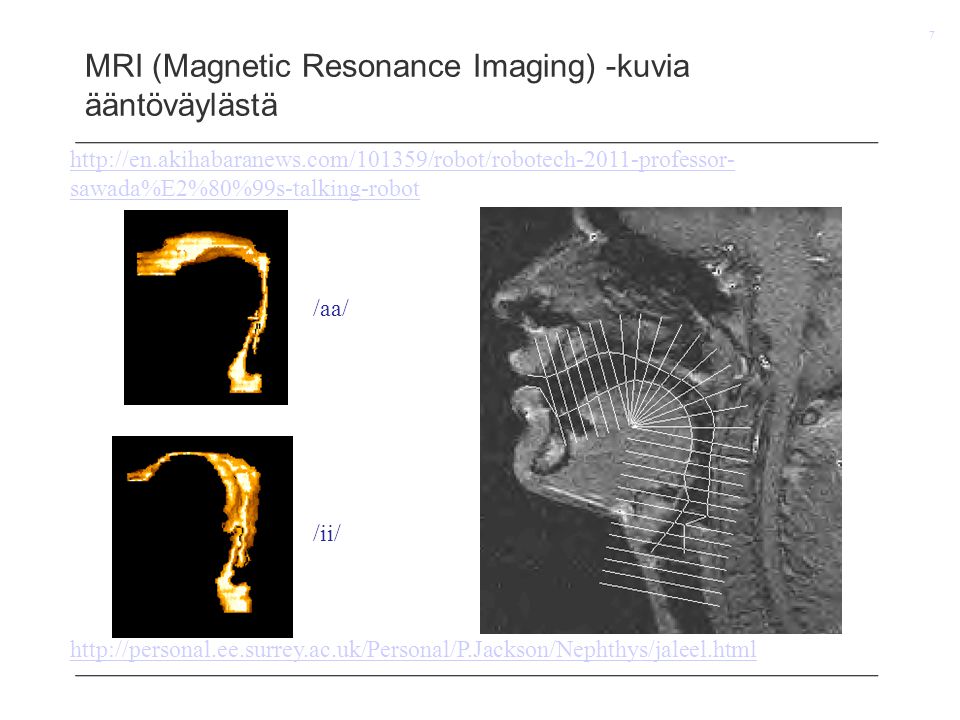 MRI (Magnetic Resonance Imaging) -kuvia ääntöväylästä
