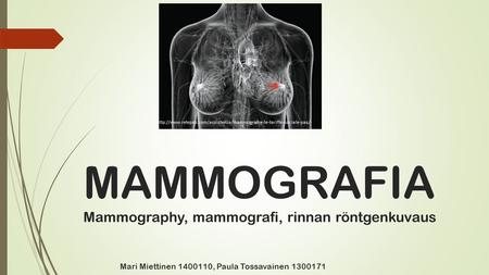 MAMMOGRAFIA Mammography, mammografi, rinnan röntgenkuvaus