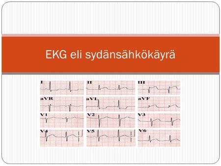 EKG eli sydänsähkökäyrä
