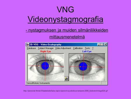 VNG Videonystagmografia