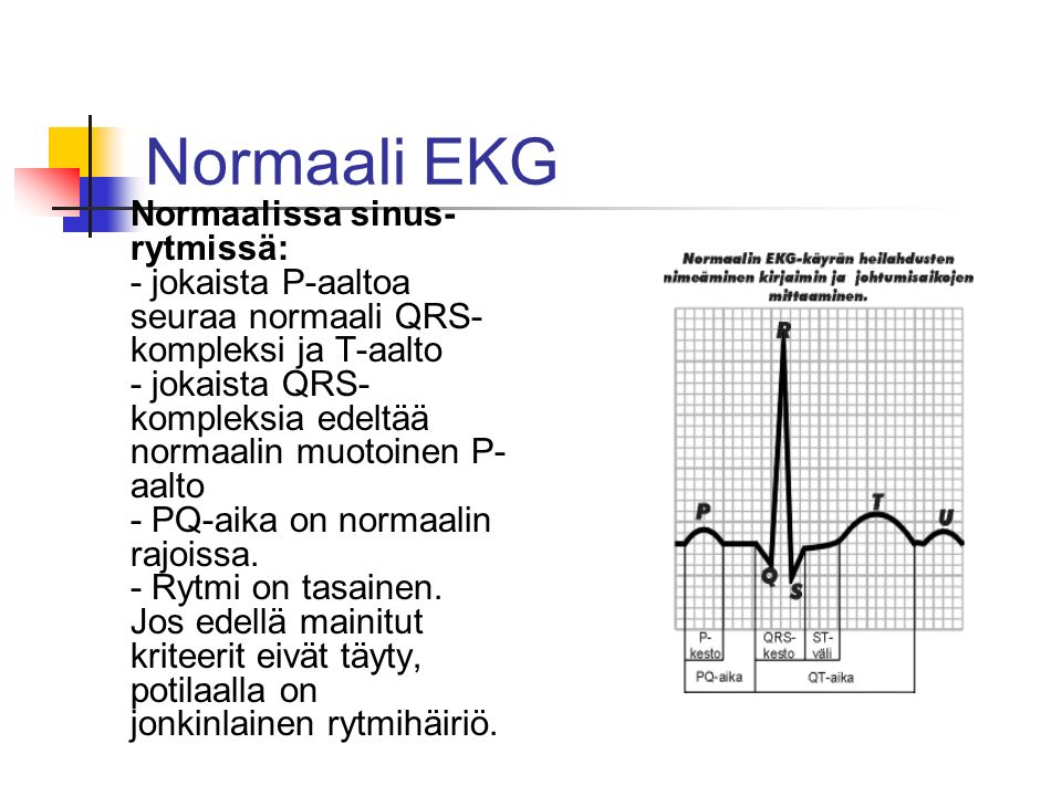 Normaali EKG