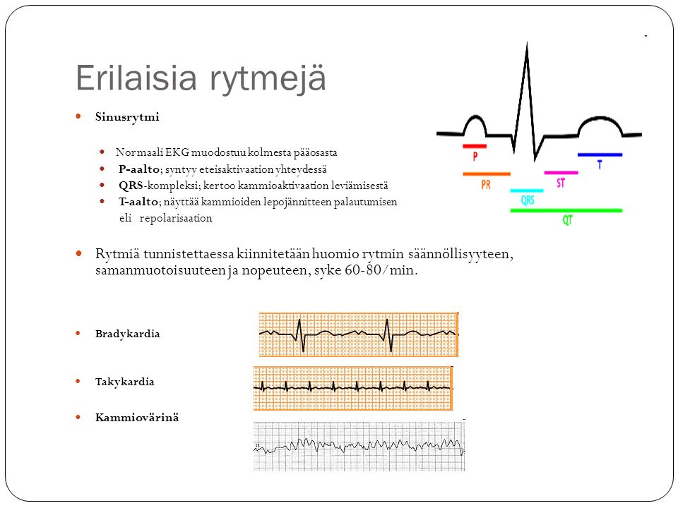 Erilaisia rytmejä Sinusrytmi. Normaali EKG muodostuu kolmesta pääosasta. P-aalto; syntyy eteisaktivaation yhteydessä.
