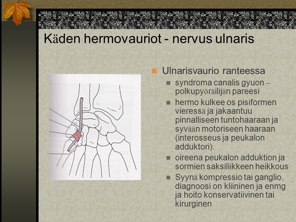 Käden hermovauriot - nervus ulnaris