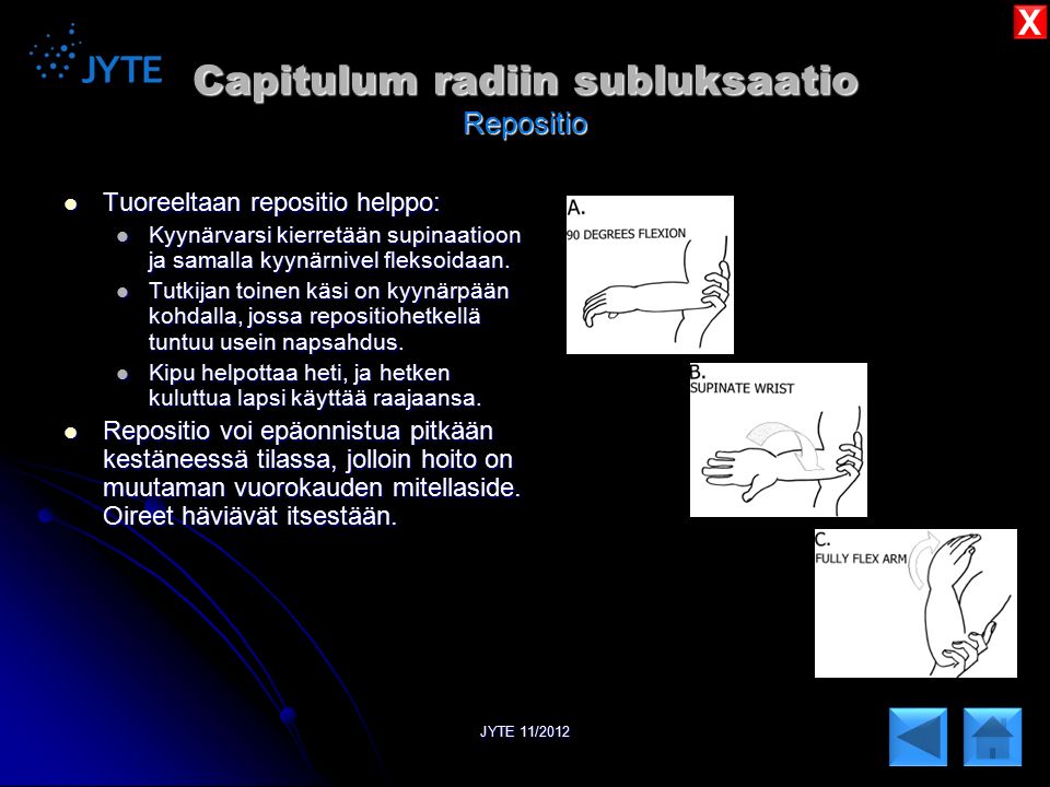Capitulum radiin subluksaatio Repositio