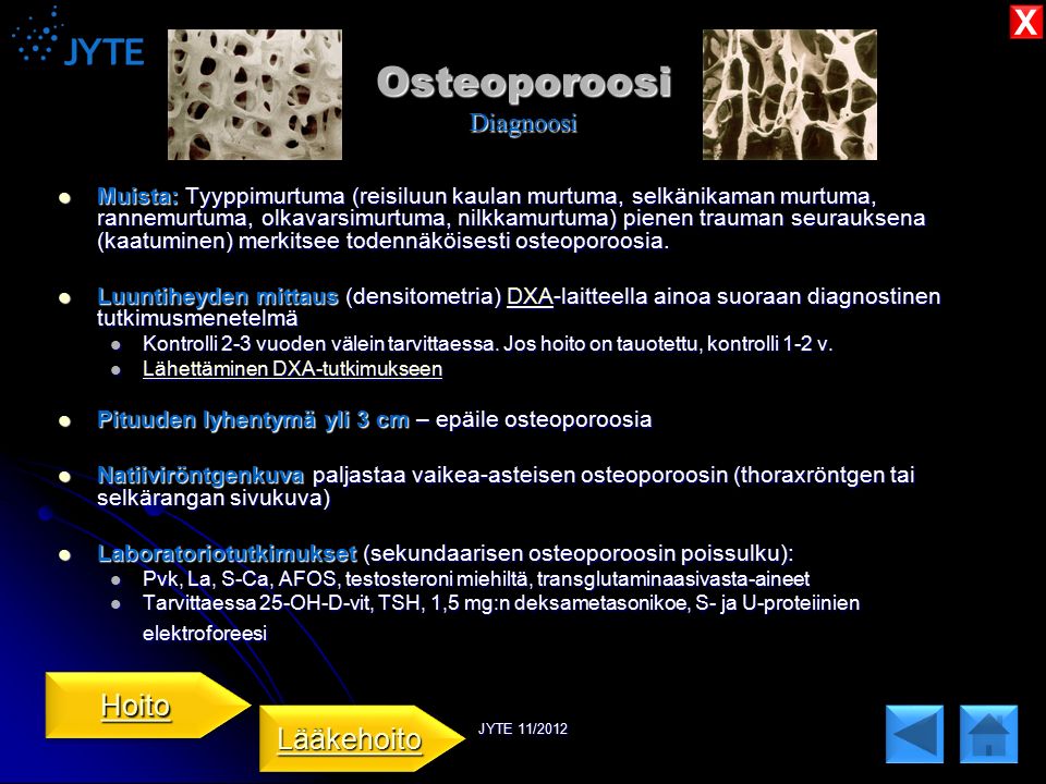 Osteoporoosi Diagnoosi