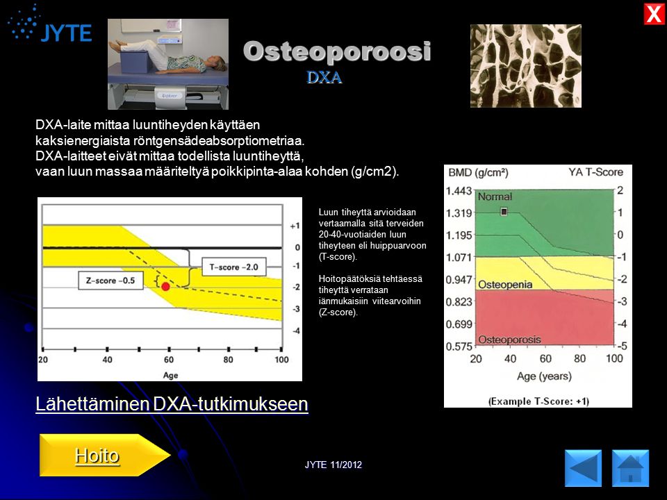 Osteoporoosi DXA X Lähettäminen DXA-tutkimukseen Hoito