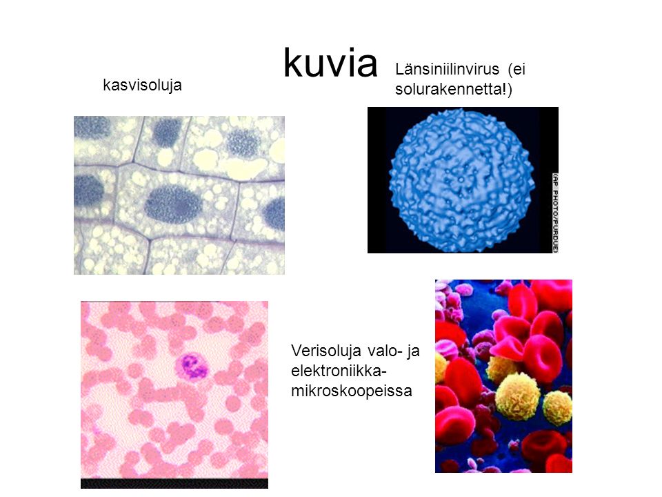 kuvia Länsiniilinvirus (ei solurakennetta!) kasvisoluja