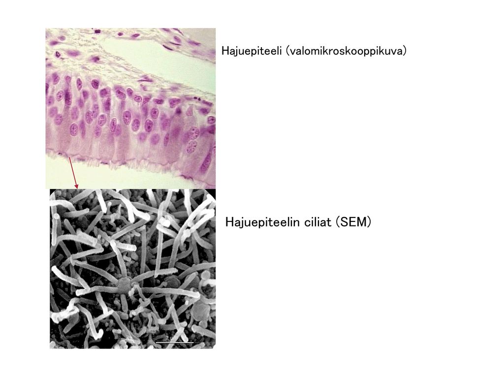 Hajuepiteelin ciliat (SEM)