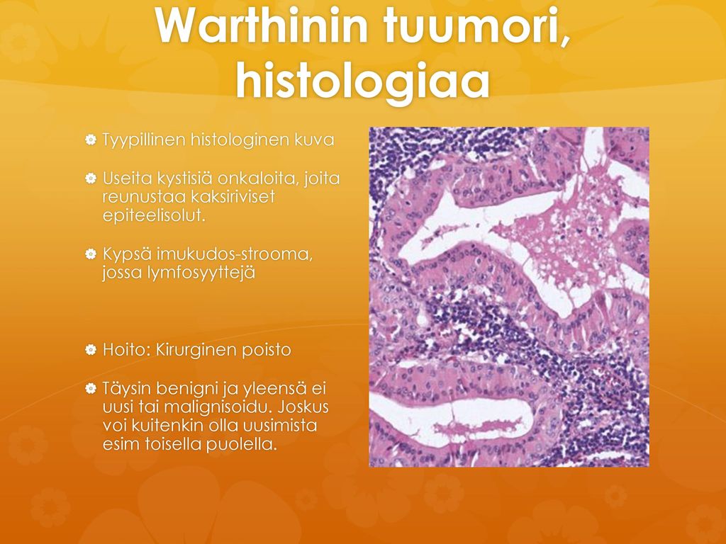 Warthinin tuumori, histologiaa