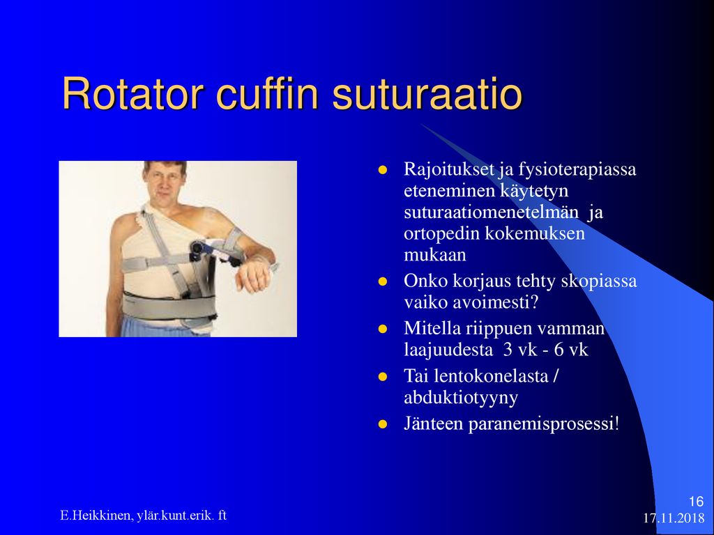 Rotator cuffin suturaatio