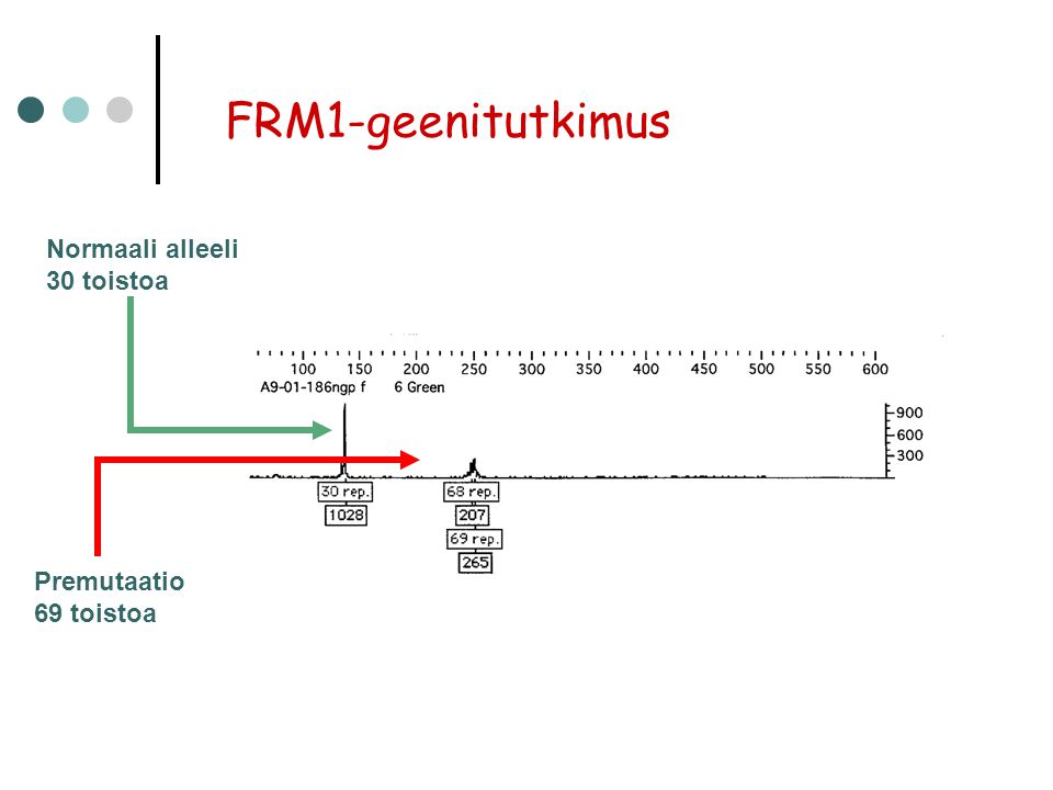 FRM1-geenitutkimus Normaali alleeli 30 toistoa Premutaatio 69 toistoa
