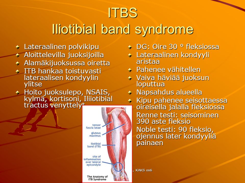 ITBS Iliotibial band syndrome