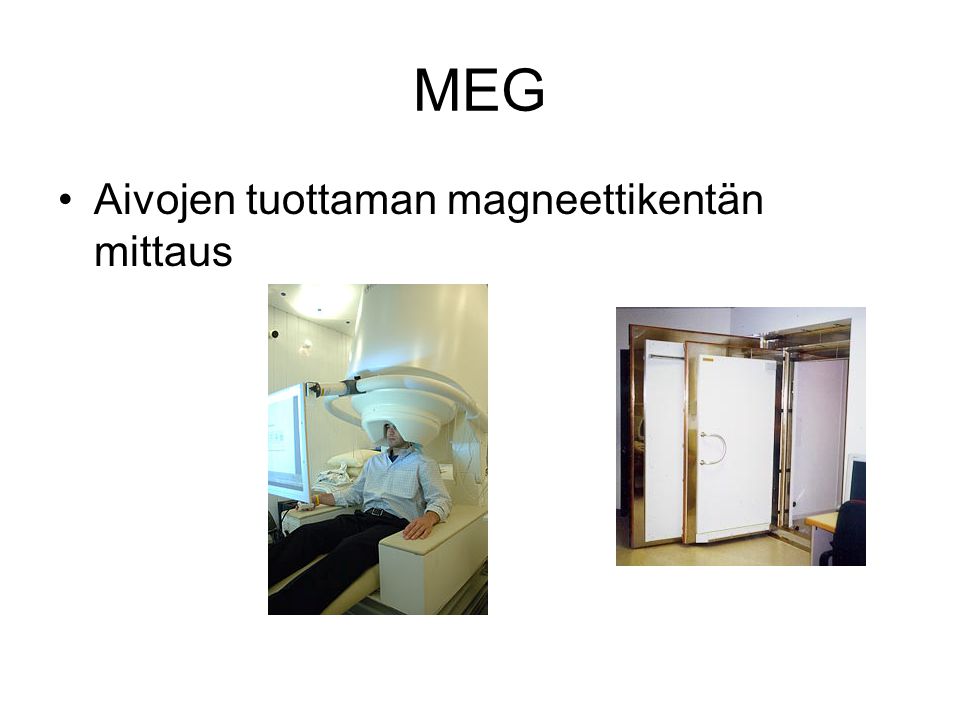 MEG Aivojen tuottaman magneettikentän mittaus