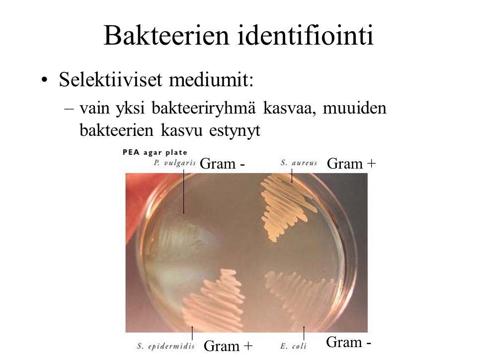 Bakteerien identifiointi