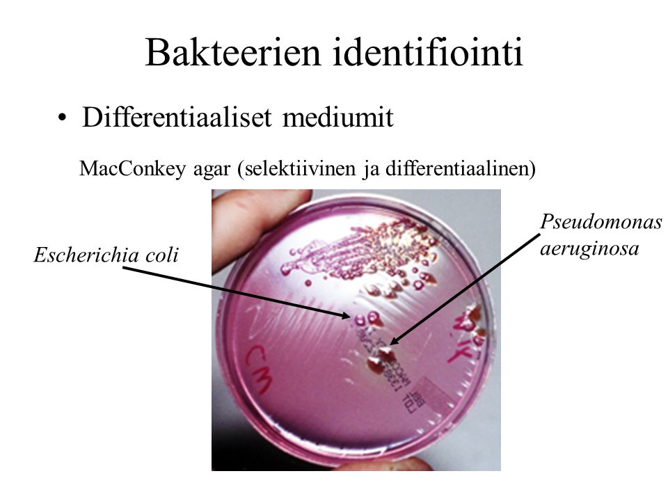 Bakteerien identifiointi