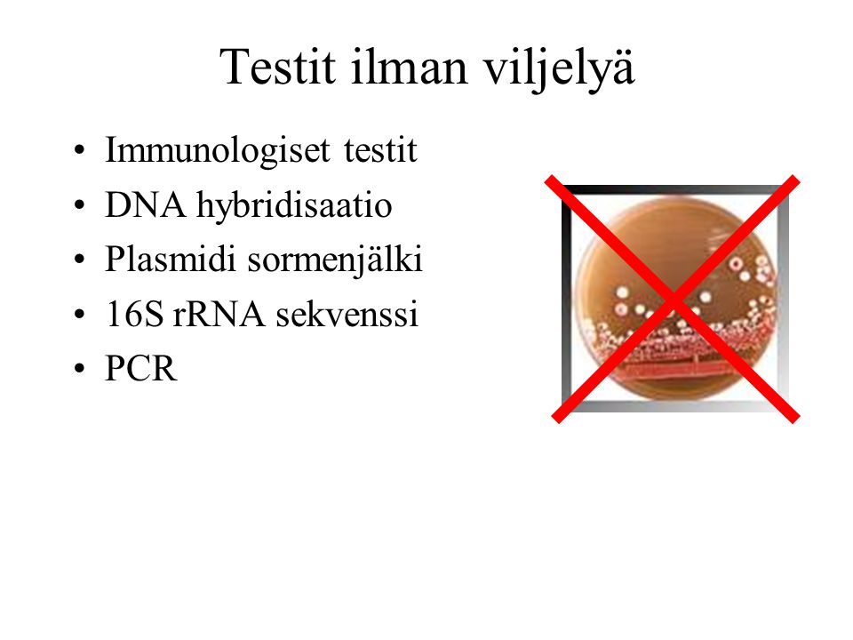 Testit ilman viljelyä Immunologiset testit DNA hybridisaatio