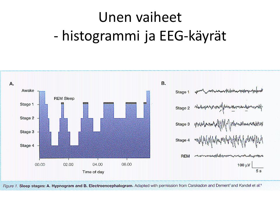 Unen vaiheet - histogrammi ja EEG-käyrät