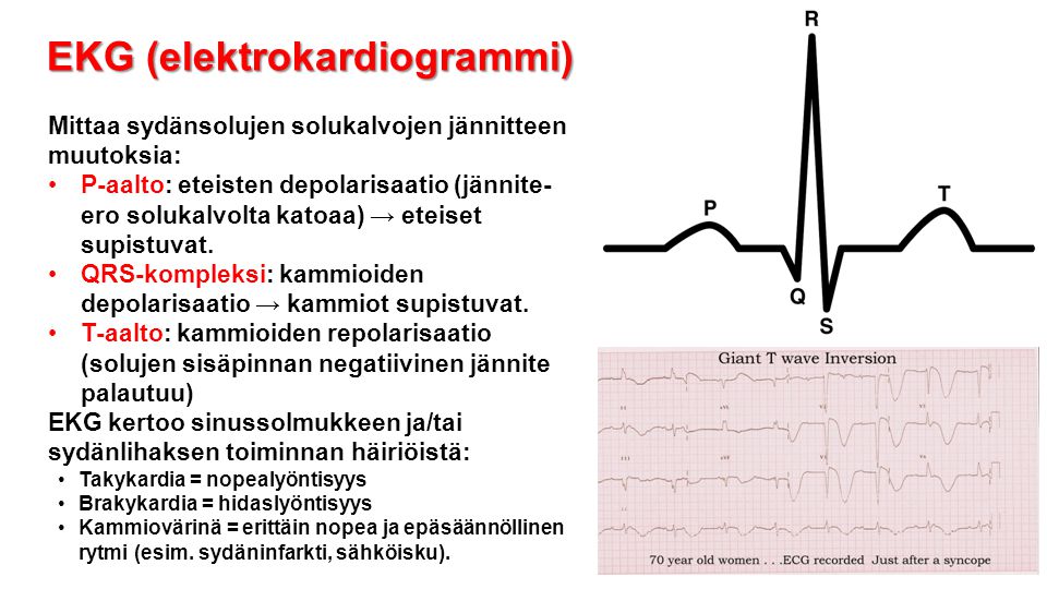 EKG (elektrokardiogrammi)
