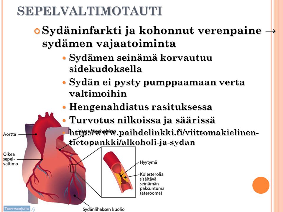 SEPELVALTIMOTAUTI Sydäninfarkti ja kohonnut verenpaine → sydämen vajaatoiminta. Sydämen seinämä korvautuu sidekudoksella.