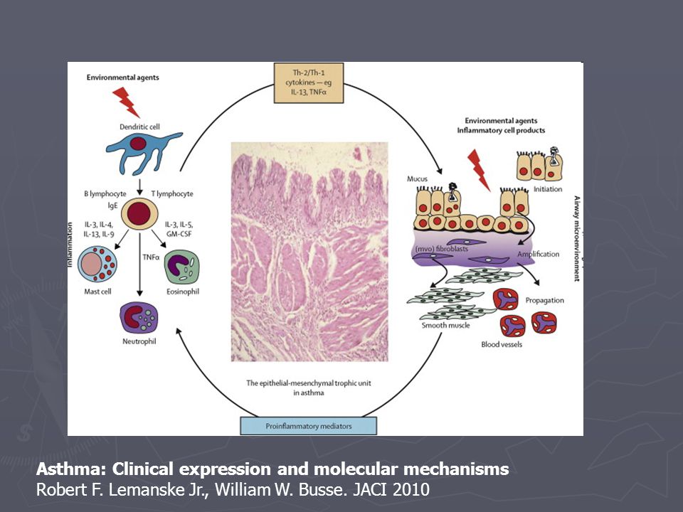 Asthma: Clinical expression and molecular mechanisms