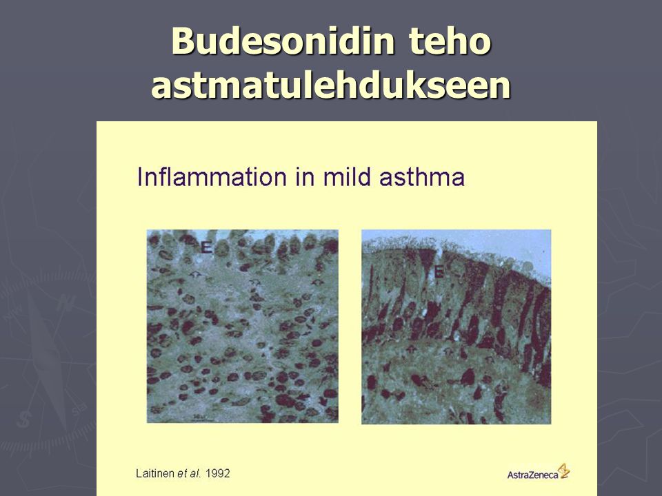 Budesonidin teho astmatulehdukseen