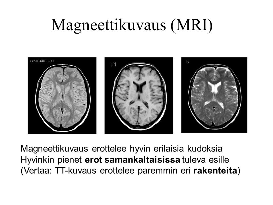 Magneettikuvaus (MRI)
