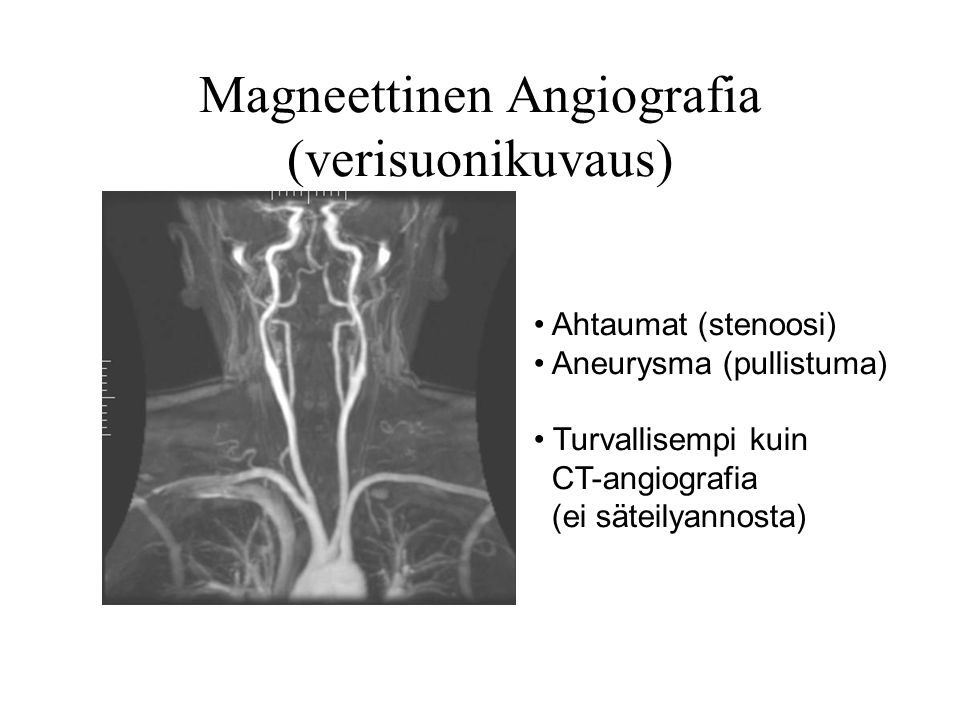 Magneettinen Angiografia (verisuonikuvaus)