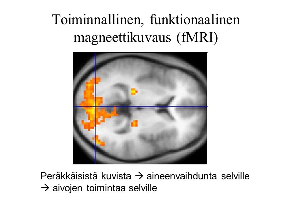 Toiminnallinen, funktionaalinen magneettikuvaus (fMRI)