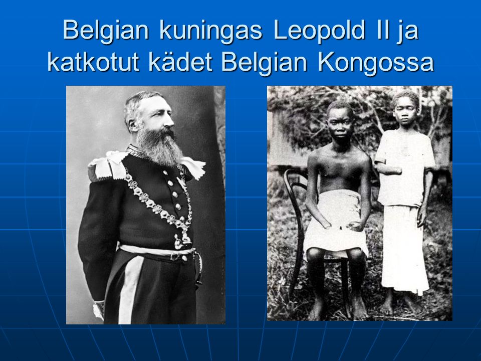 Belgian kuningas Leopold II ja katkotut kädet Belgian Kongossa